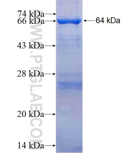 ECT2 fusion protein Ag24860 SDS-PAGE