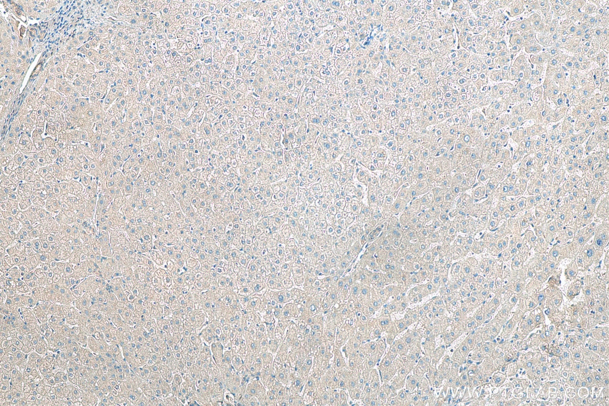 Immunohistochemistry (IHC) staining of human liver tissue using EDA Polyclonal antibody (25892-1-AP)