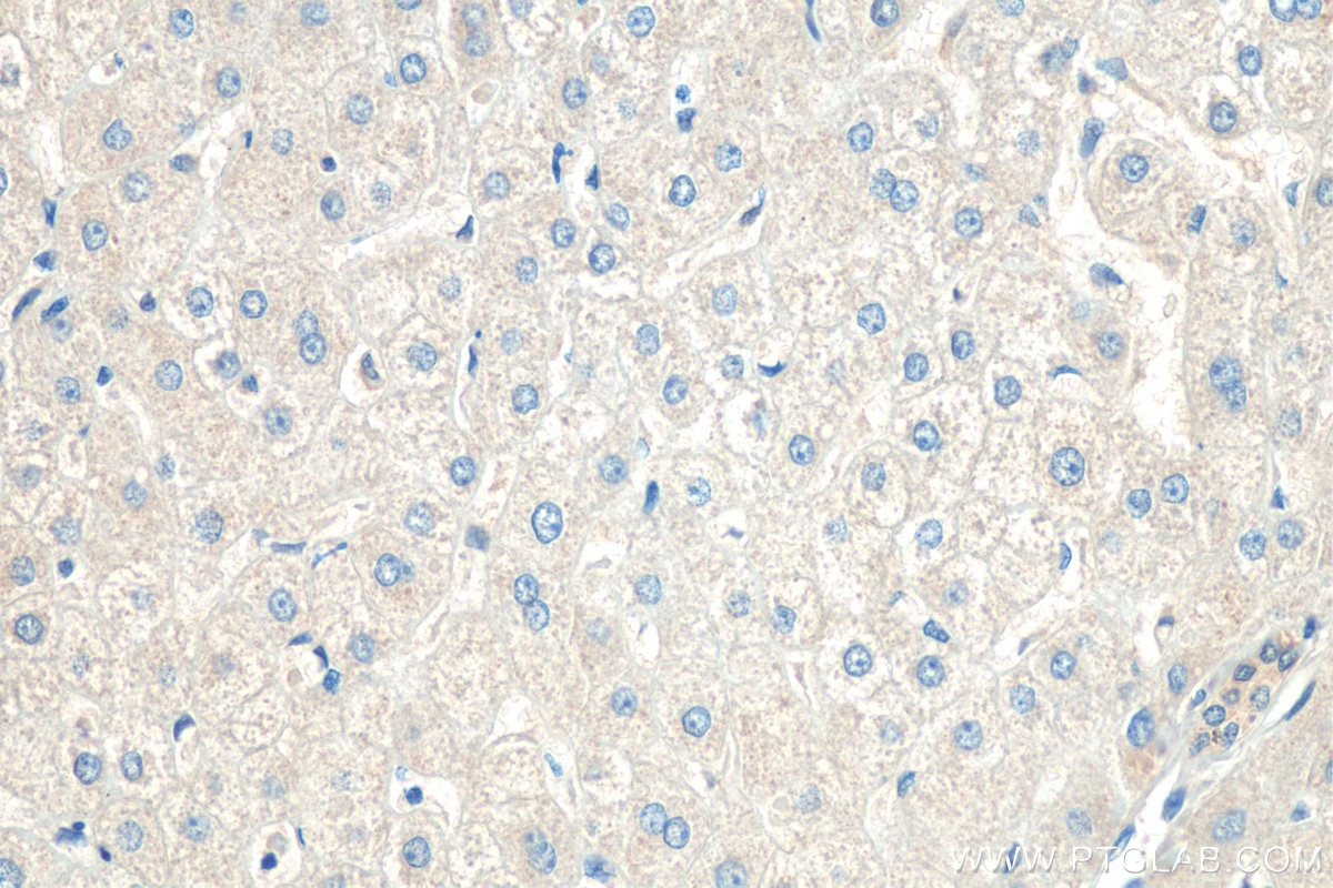 Immunohistochemistry (IHC) staining of human liver tissue using EDA Polyclonal antibody (25892-1-AP)