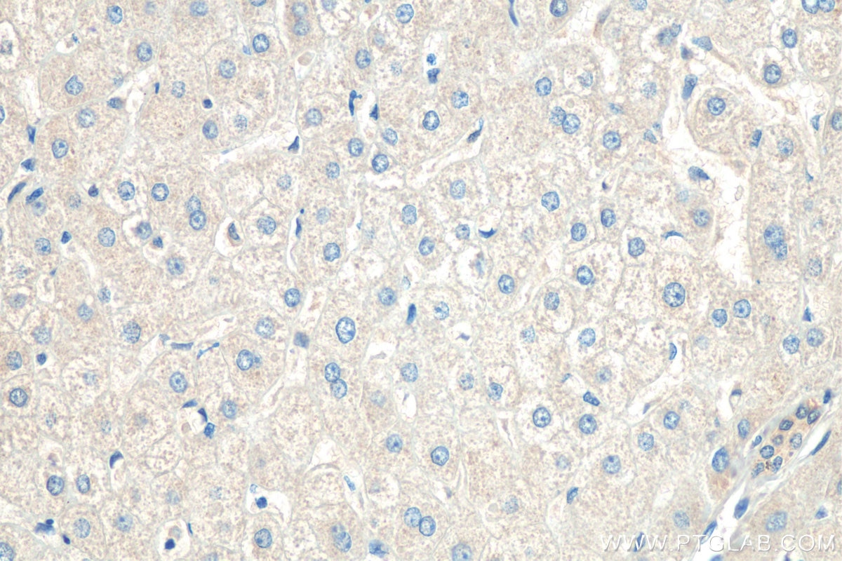 Immunohistochemistry (IHC) staining of human liver tissue using EDA Polyclonal antibody (25892-1-AP)