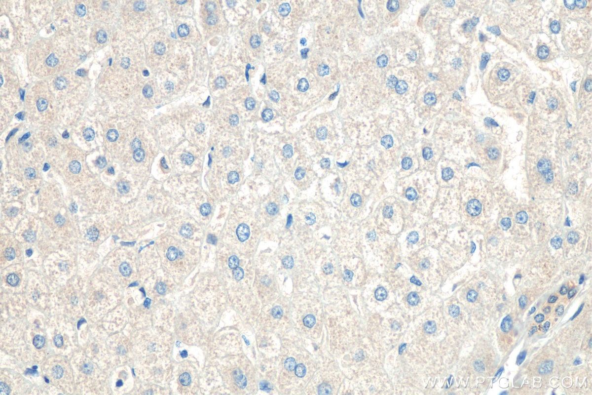 IHC staining of human liver using 25892-1-AP