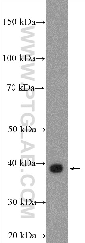 Western Blot (WB) analysis of mouse liver tissue using EDA Polyclonal antibody (25892-1-AP)