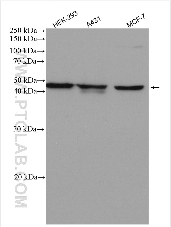 Western Blot (WB) analysis of various lysates using EDAR Polyclonal antibody (18032-1-AP)