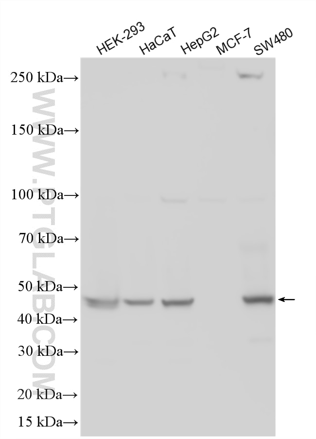 Western Blot (WB) analysis of various lysates using EDAR Polyclonal antibody (18032-1-AP)