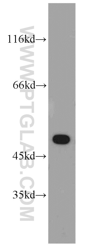 Western Blot (WB) analysis of A549 cells using EDAR Polyclonal antibody (18032-1-AP)