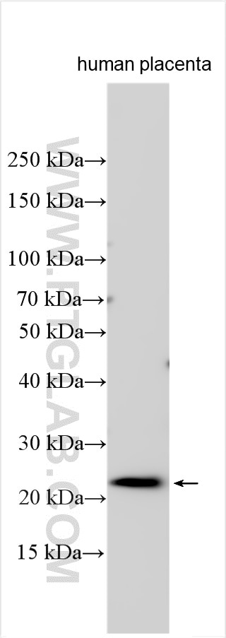 WB analysis using 32485-1-AP (same clone as 32485-1-PBS) Western Blot (WB) analysis of various lysates using EDARADD Polyclonal antibody (32485-1-AP)