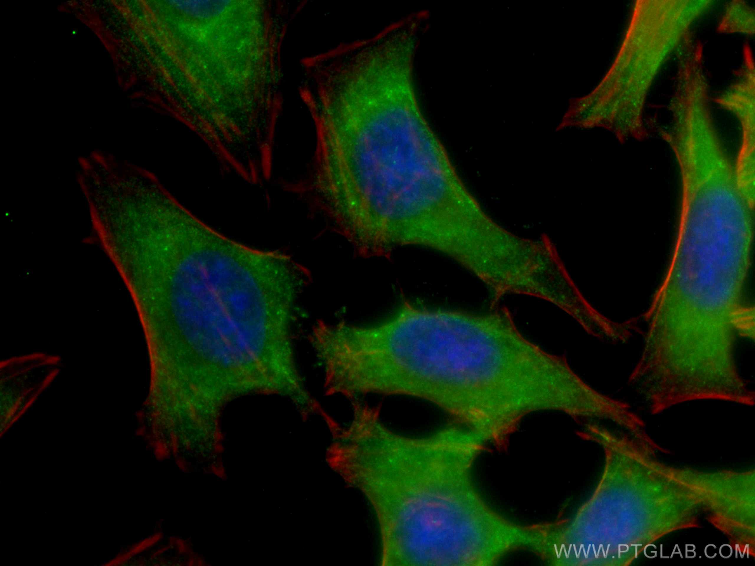 Immunofluorescence (IF) / fluorescent staining of HeLa cells using EDC3 Polyclonal antibody (16486-1-AP)