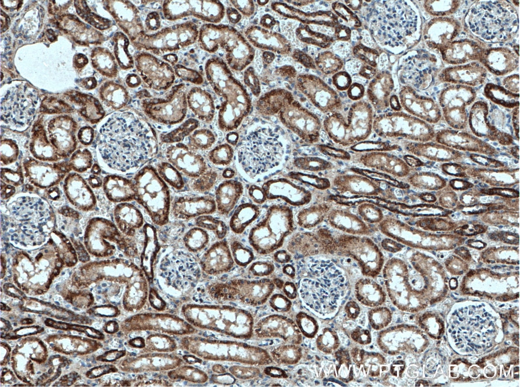 Immunohistochemistry (IHC) staining of human kidney tissue using EDC3 Polyclonal antibody (16486-1-AP)