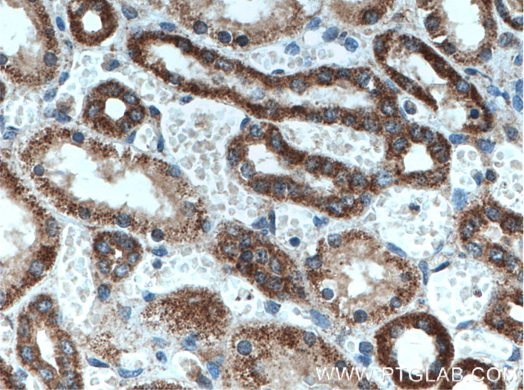 Immunohistochemistry (IHC) staining of human kidney tissue using EDC3 Polyclonal antibody (16486-1-AP)