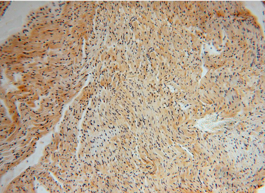 Immunohistochemistry (IHC) staining of human heart tissue using EDC3 Polyclonal antibody (16486-1-AP)