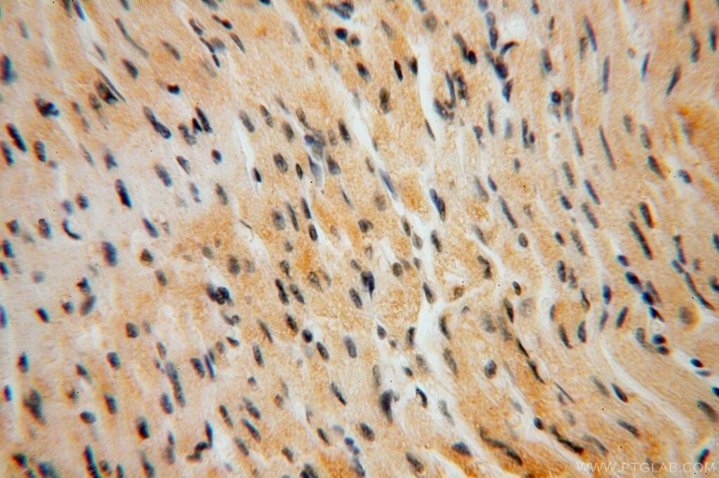 IHC staining of human heart using 16486-1-AP