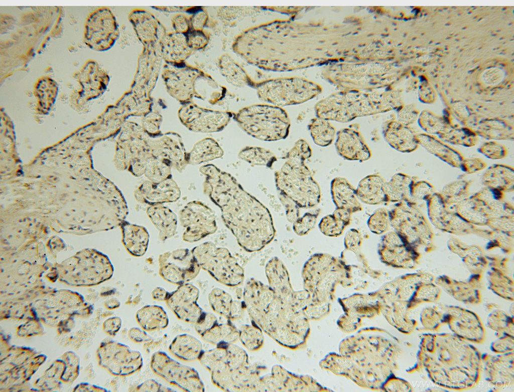 Immunohistochemistry (IHC) staining of human placenta tissue using EDC3 Polyclonal antibody (16486-1-AP)