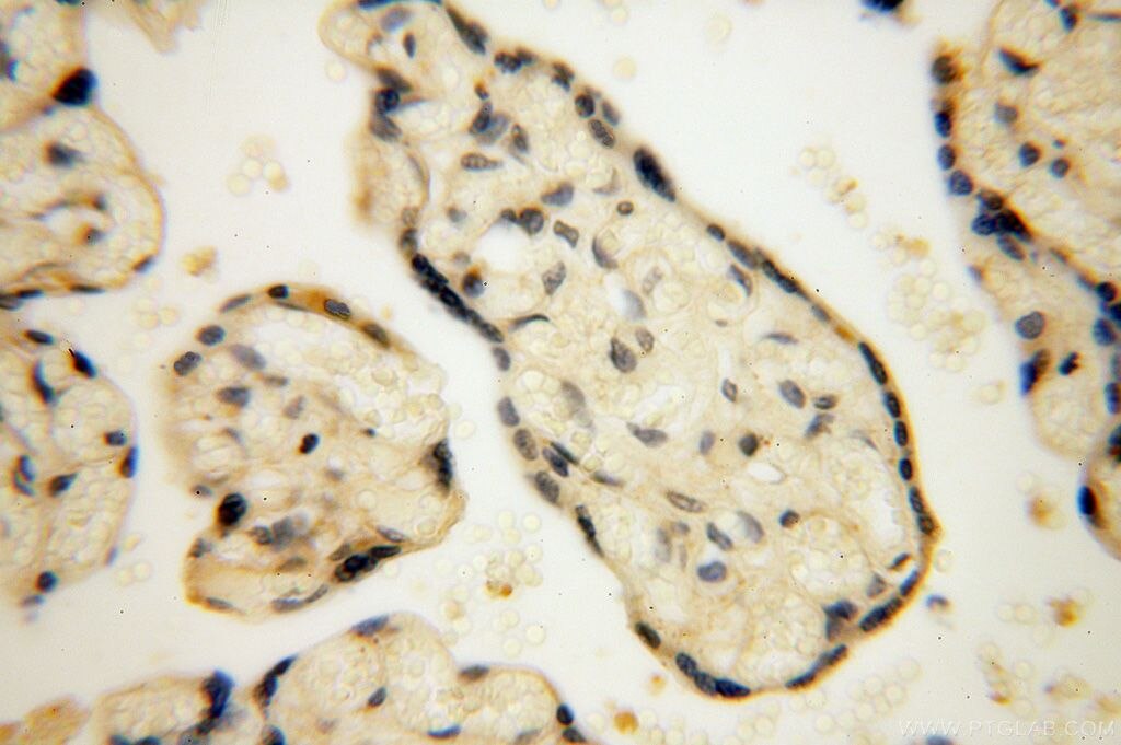 Immunohistochemistry (IHC) staining of human placenta tissue using EDC3 Polyclonal antibody (16486-1-AP)