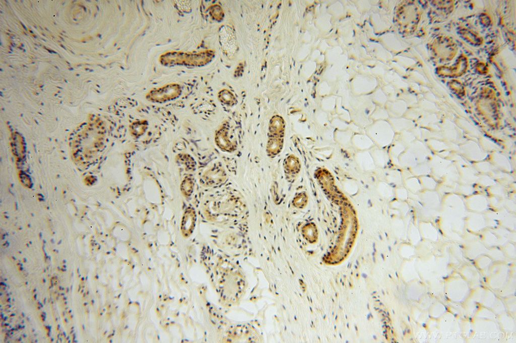 Immunohistochemistry (IHC) staining of human skin tissue using EDC3 Polyclonal antibody (16486-1-AP)