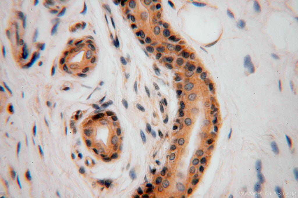 Immunohistochemistry (IHC) staining of human skin tissue using EDC3 Polyclonal antibody (16486-1-AP)