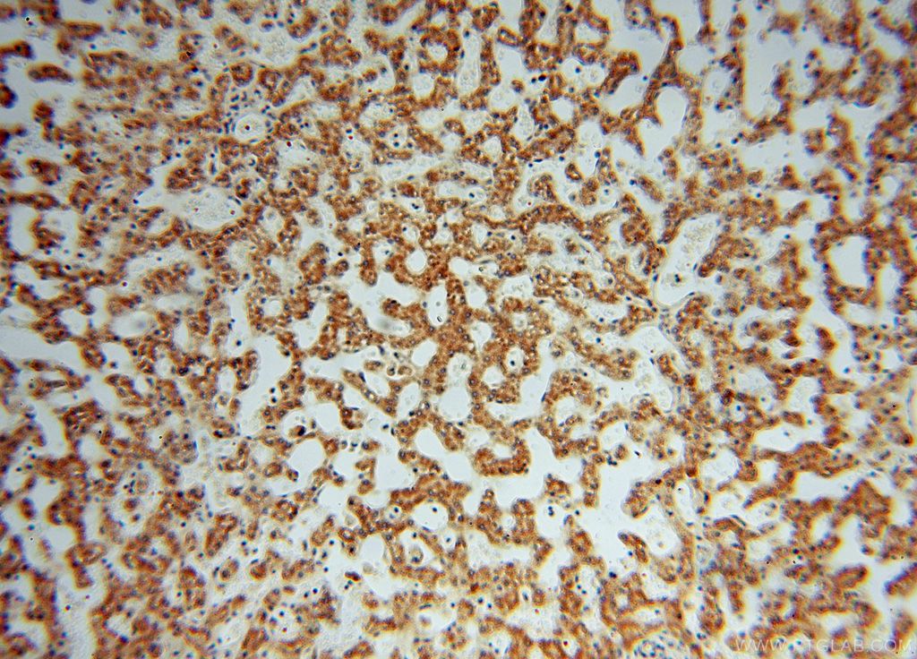 IHC staining of human liver using 16486-1-AP