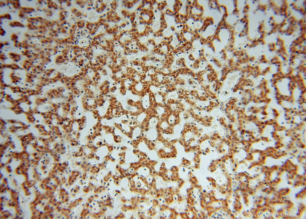 Immunohistochemistry (IHC) staining of human liver tissue using EDC3 Polyclonal antibody (16486-1-AP)