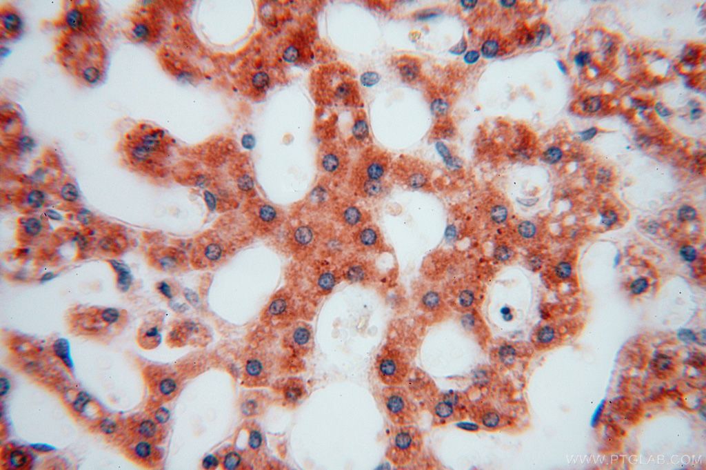 Immunohistochemistry (IHC) staining of human liver tissue using EDC3 Polyclonal antibody (16486-1-AP)