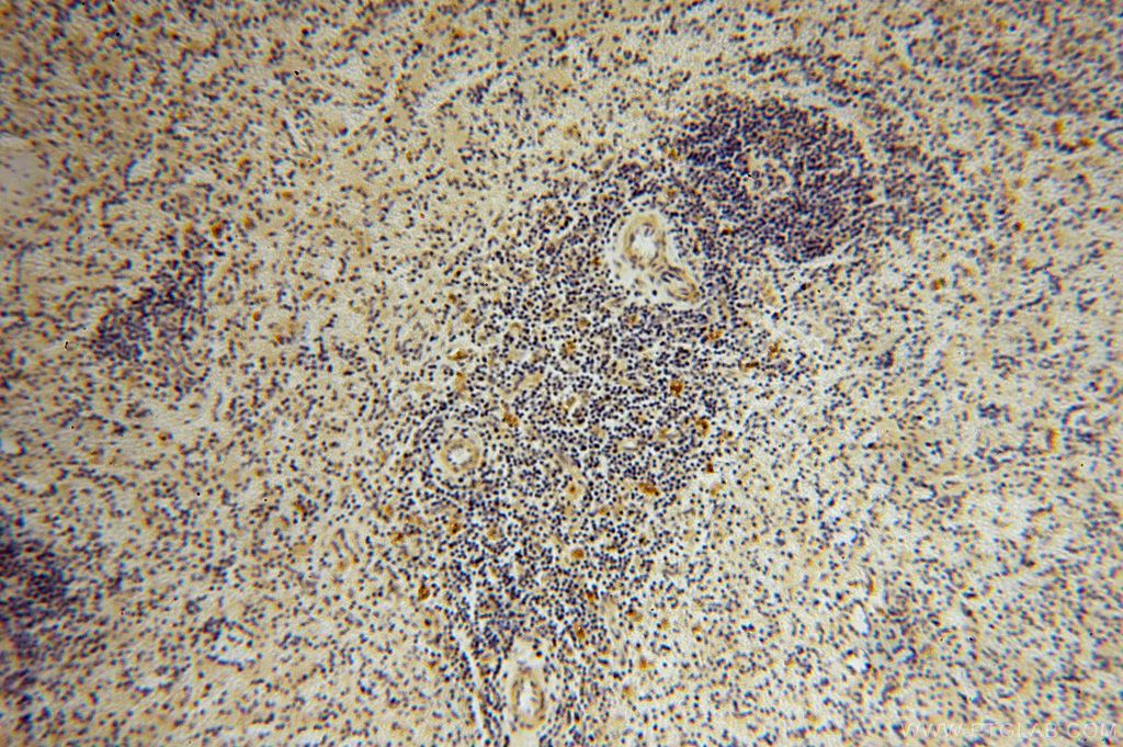 Immunohistochemistry (IHC) staining of human spleen tissue using EDC3 Polyclonal antibody (16486-1-AP)