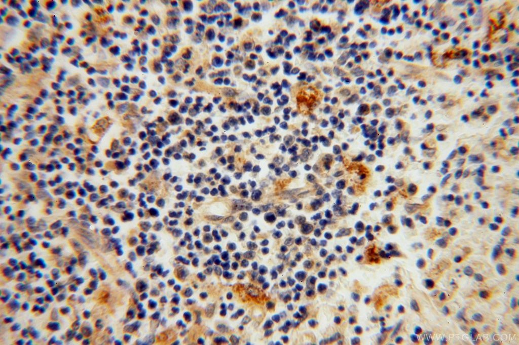 Immunohistochemistry (IHC) staining of human spleen tissue using EDC3 Polyclonal antibody (16486-1-AP)