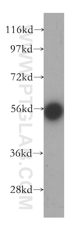 Western Blot (WB) analysis of MCF-7 cells using EDC3 Polyclonal antibody (16486-1-AP)