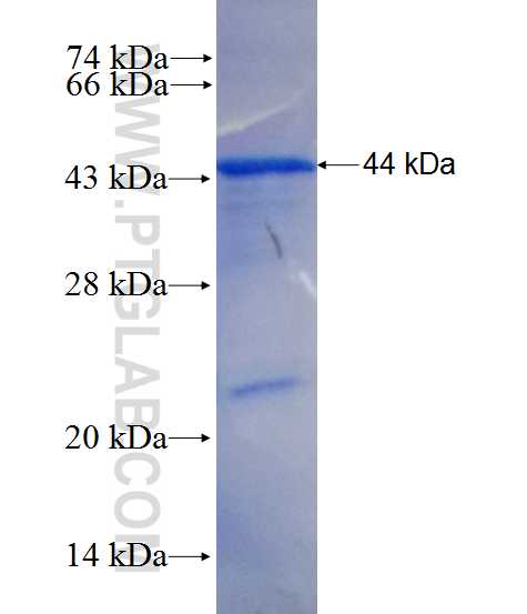 EDC3 fusion protein Ag10241 SDS-PAGE