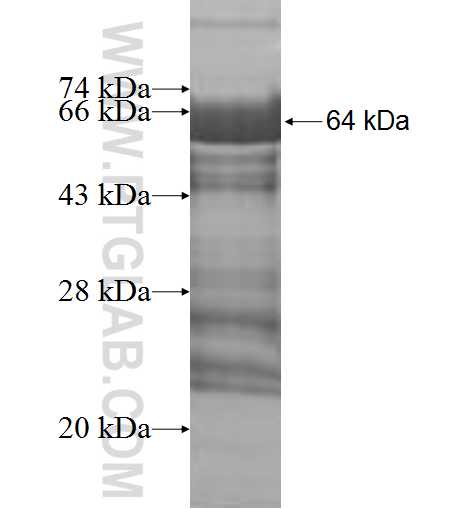 EDC3 fusion protein Ag9608 SDS-PAGE