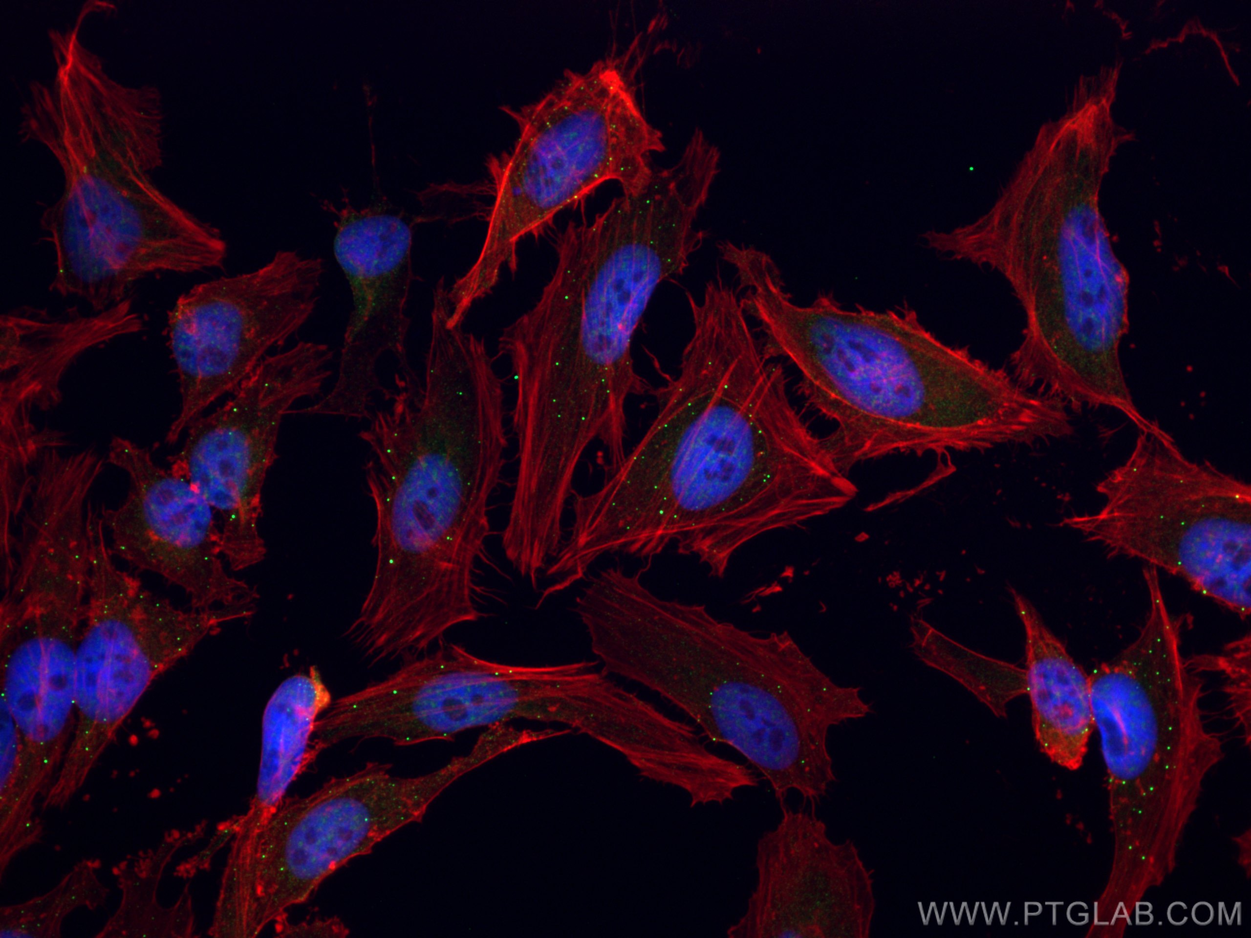 Immunofluorescence (IF) / fluorescent staining of HeLa cells using EDC4 Polyclonal antibody (17737-1-AP)