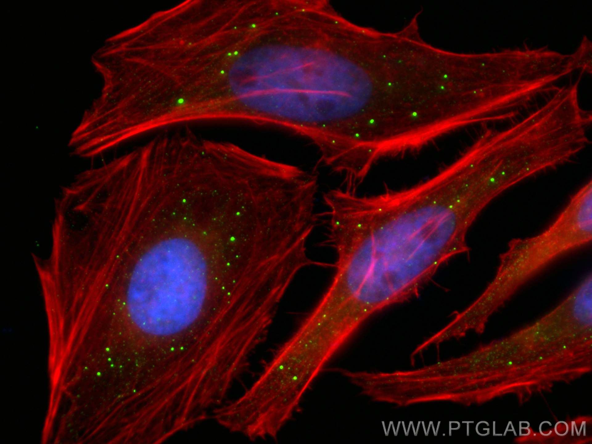 Immunofluorescence (IF) / fluorescent staining of HeLa cells using EDC4 Polyclonal antibody (17737-1-AP)