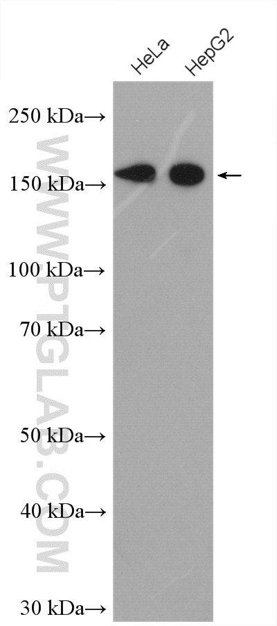 Western Blot (WB) analysis of various lysates using EDC4 Polyclonal antibody (17737-1-AP)