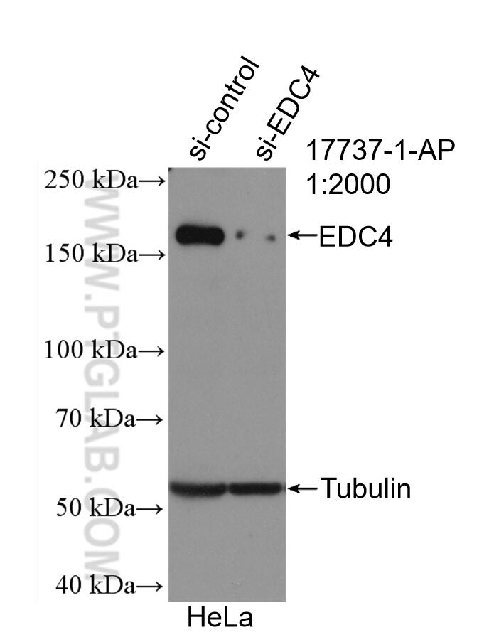 Western Blot (WB) analysis of HeLa cells using EDC4 Polyclonal antibody (17737-1-AP)