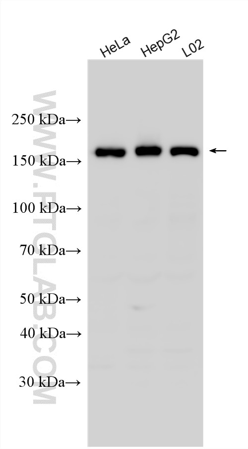 WB analysis using 17737-1-AP Western Blot (WB) analysis of various lysates using EDC4 Polyclonal antibody (17737-1-AP)
