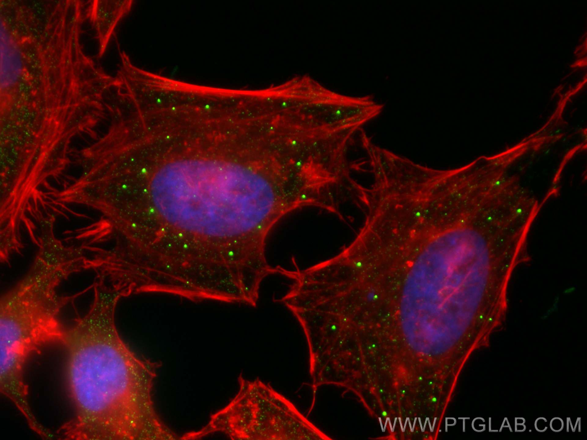 Immunofluorescence (IF) / fluorescent staining of HeLa cells using CoraLite® Plus 488-conjugated EDC4 Polyclonal anti (CL488-17737)