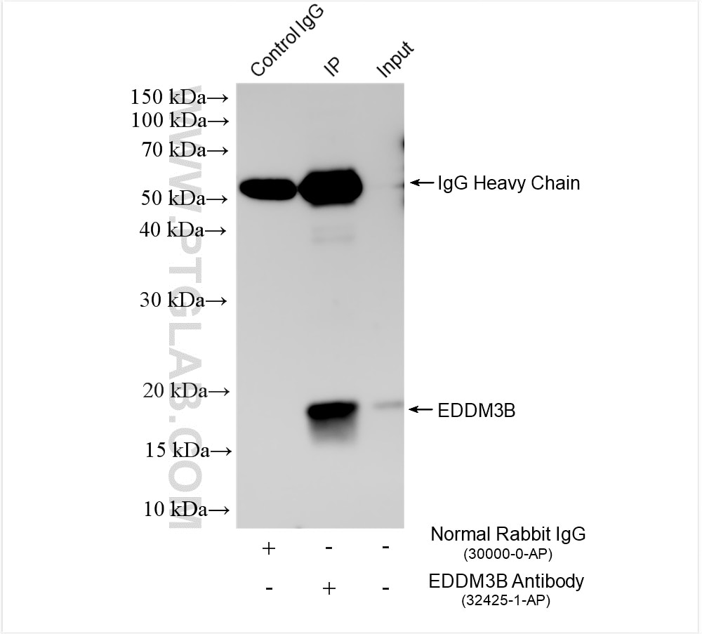 Immunoprecipitation (IP) experiment of human testis tissue using EDDM3B Polyclonal antibody (32425-1-AP)