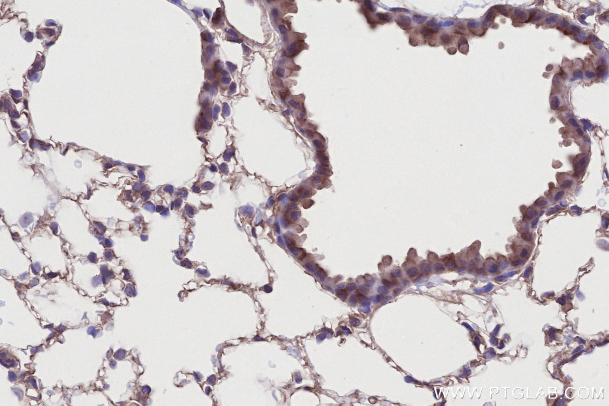 IHC staining of mouse lung using 26226-1-AP Immunohistochemistry (IHC) staining of mouse lung tissue using EDEM1 Polyclonal antibody (26226-1-AP)