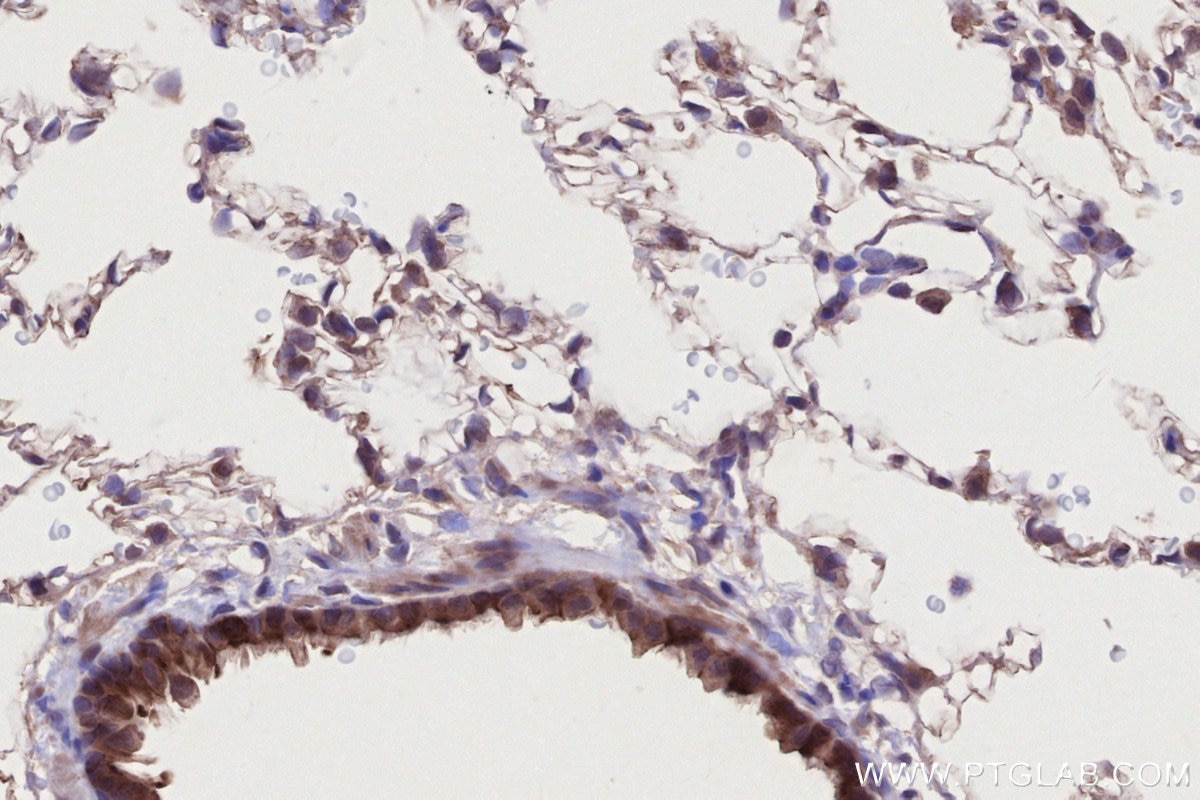 IHC staining of rat lung using 26226-1-AP Immunohistochemistry (IHC) staining of rat lung tissue using EDEM1 Polyclonal antibody (26226-1-AP)