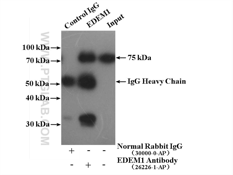 Immunoprecipitation (IP) experiment of mouse liver tissue using EDEM1 Polyclonal antibody (26226-1-AP)