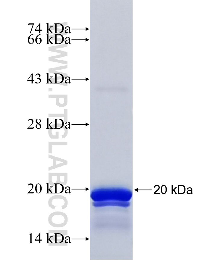 EDEM1 fusion protein Ag41790 SDS-PAGE EDEM1 fusion protein Ag41790 SDS-PAGE
