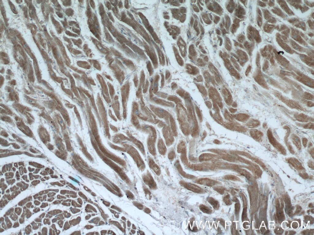 IHC staining of human heart using 11241-1-AP