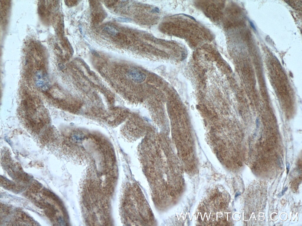 Immunohistochemistry (IHC) staining of human heart tissue using EDEM2 Polyclonal antibody (11241-1-AP)