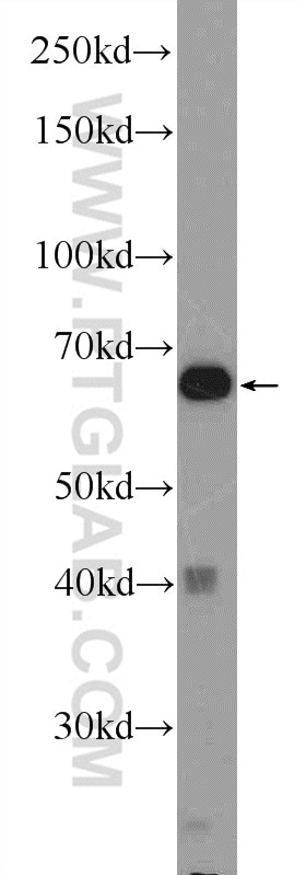 WB analysis of mouse skeletal muscle using 11241-1-AP