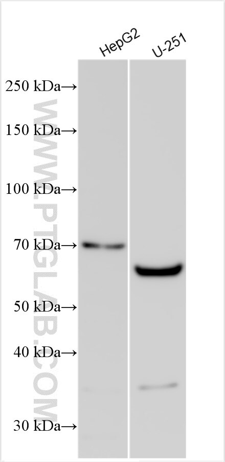 Western Blot (WB) analysis of various lysates using EDEM2 Polyclonal antibody (11241-1-AP)