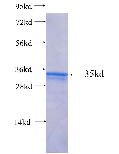EDEM3 fusion protein Ag26123 SDS-PAGE