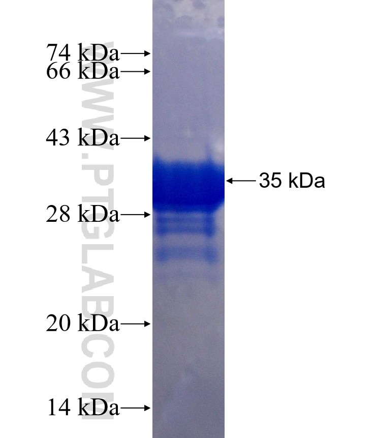 EDEM3 fusion protein Ag26123 SDS-PAGE