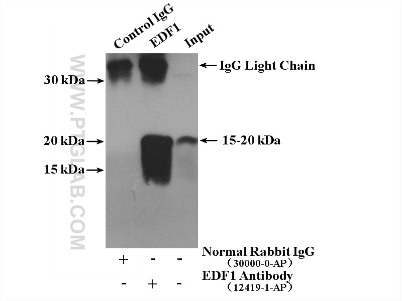Immunoprecipitation (IP) experiment of Jurkat cells using EDF1 Polyclonal antibody (12419-1-AP)