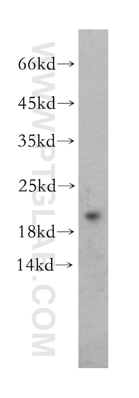 Western Blot (WB) analysis of mouse pancreas tissue using EDF1 Polyclonal antibody (12419-1-AP)