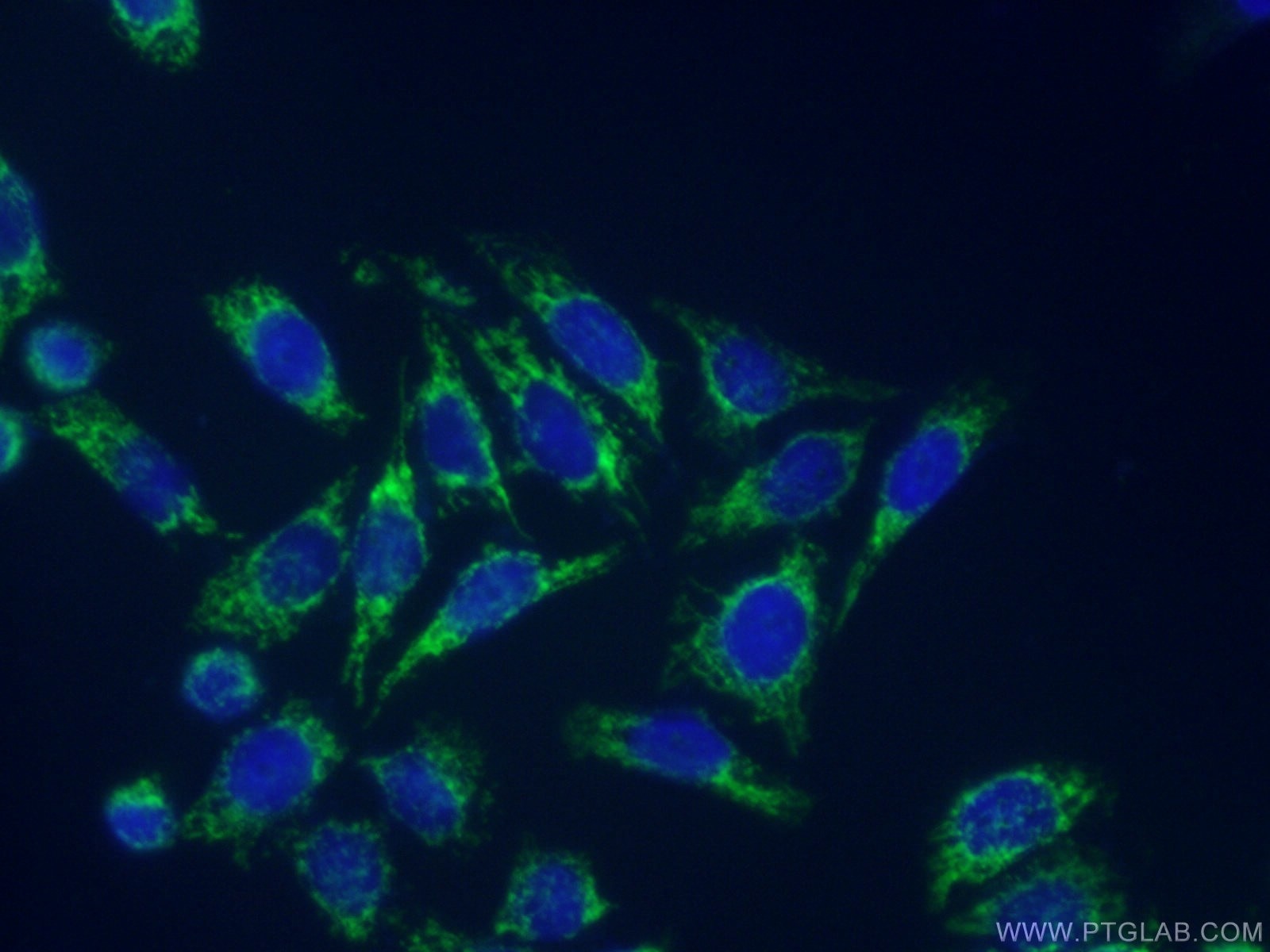 IF Staining of HeLa using 12580-1-AP