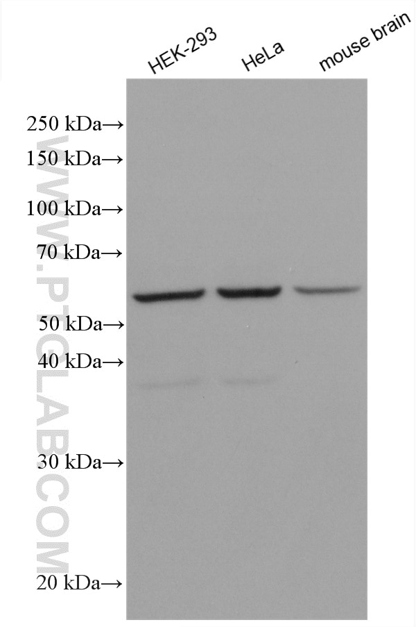 Western Blot (WB) analysis of various lysates using EDIL3 Polyclonal antibody (12580-1-AP)