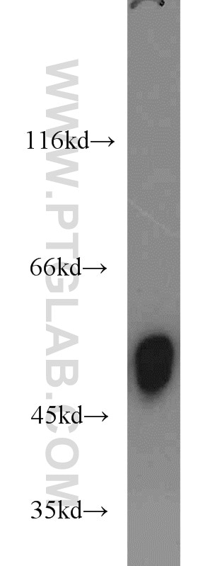 WB analysis of COLO 320 using 12580-1-AP