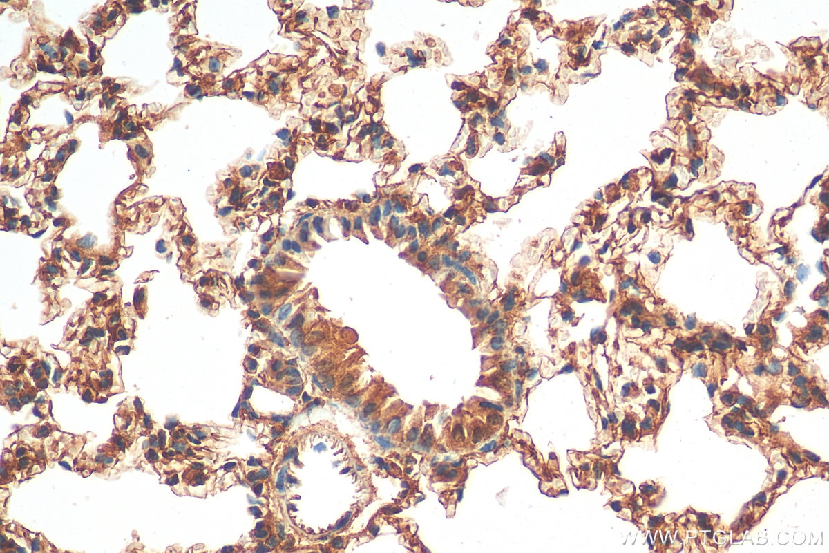 Immunohistochemistry (IHC) staining of mouse lung tissue using Endothelin 1 Polyclonal antibody (12191-1-AP)